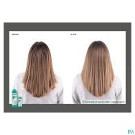 Klorane shampooing sec ortie + vitamine e 150ml | Aesiel