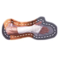 Houss protect donjoy plat m/supenf