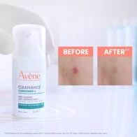 Avene cleanance comedomed+ spf30